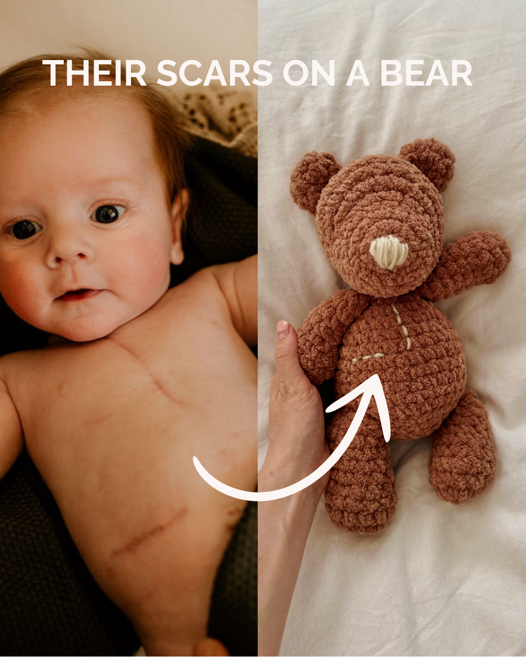 Ted - My Scar Buddy